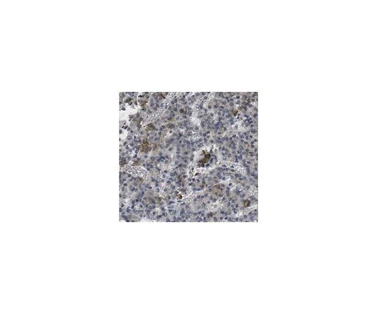 62-8458-21　［已停用］抗GHRHR　ABC445