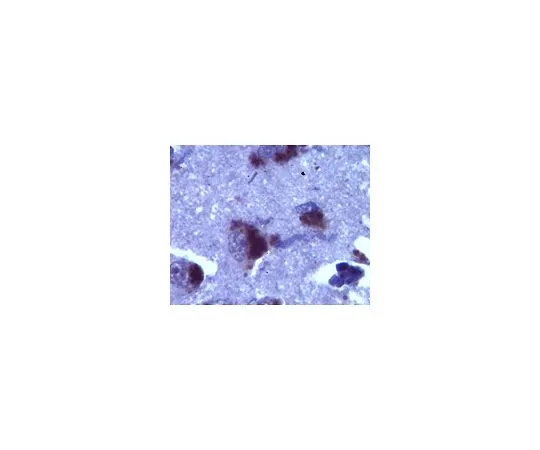 62-8465-36　［已停用］抗纽瑞欣-1α;100μL　ABN35