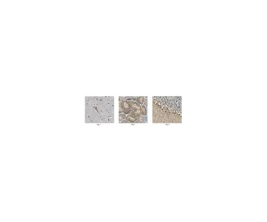 62-8467-17　［已停用］抗mSphK1抗体猫。不，是ABN435　ABN435