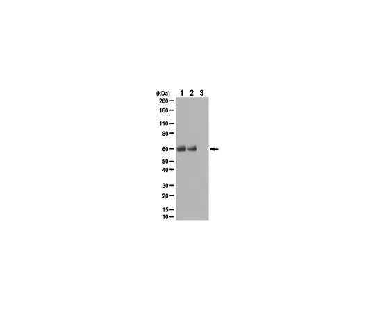 62-8456-75　［已停用］抗磷-Src (Tyr419);50μg　ABC105