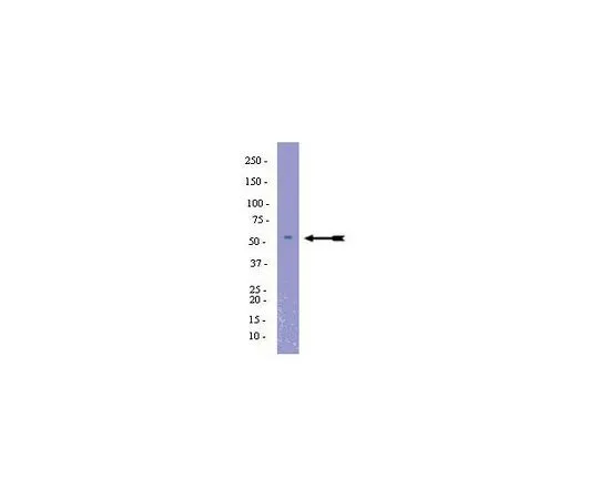 62-8389-88　［已停用］抗PAI-1;100μg　09-726