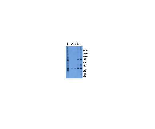62-8452-79　［已停用］抗APH-1;100μL　AB9214