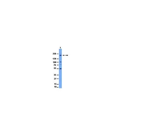 62-8385-13　［已停用］抗阿克努斯，NT;200μL　07-447