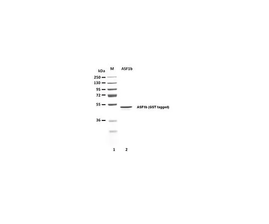 62-8391-98　［已停用］人重组ASF1b, 25 ug　14-1115