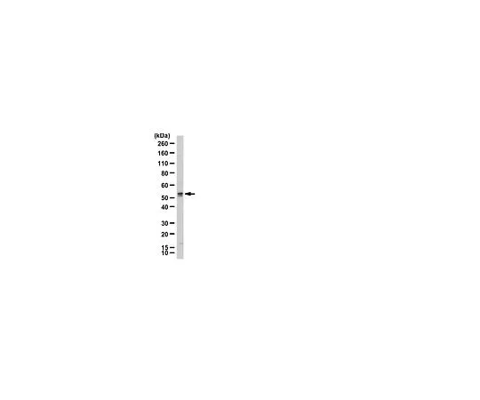 62-8389-14　［已停用］抗CBX6;100μg　09-030