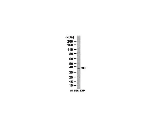 62-8472-96　［已停用］反角化症;100μg　ABT154