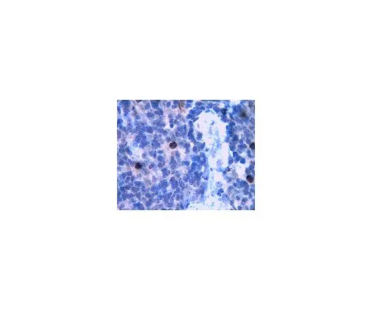 62-8472-35　［已停用］抗MMP-8 (铰链区域);100μg　ABT38