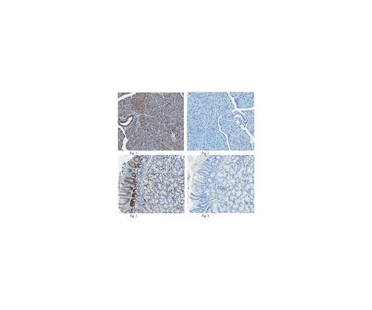 62-8469-38　［已停用］抗Wr-1;100μg　ABS99