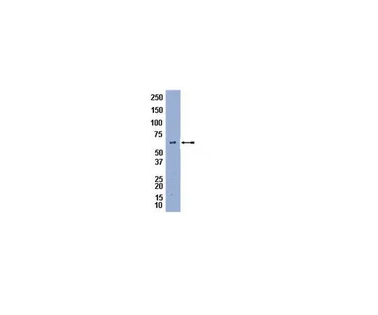 62-8454-17　［已停用］抗佩尔平A;100μg　AB10200