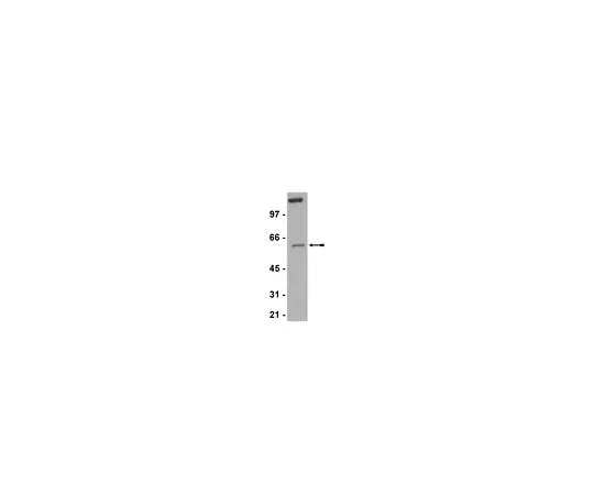 62-8386-56　［已停用］反RIAP-3 (XIAP);200μg　07-753