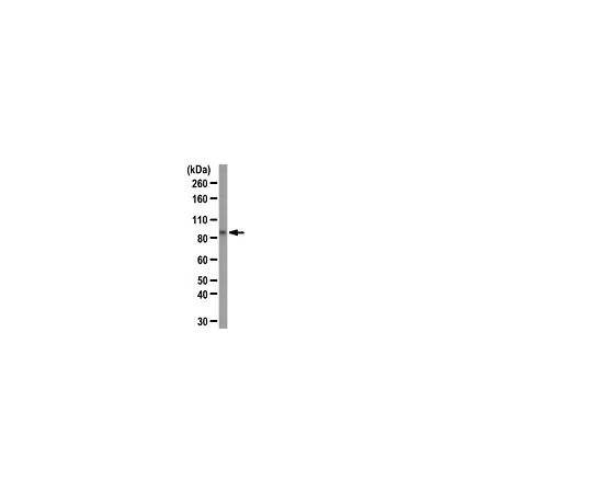 62-8388-25　［已停用］抗β卡泰宁;100μg　07-1653