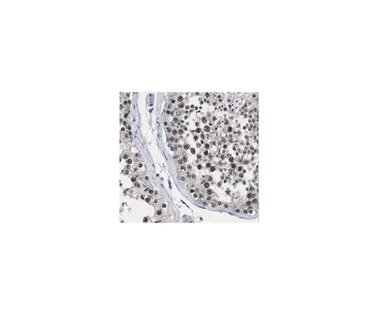 62-8458-23　［已停用］抗HIAP-2 (CIAP-1)　ABC448