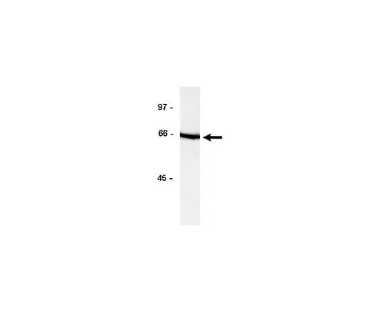 62-8381-62　［已停用］反技术;200μg　06-561