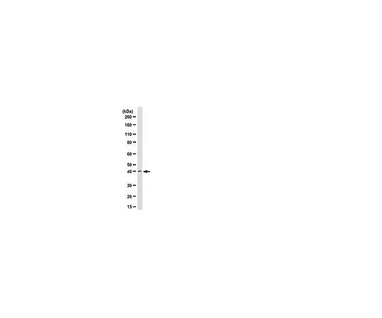 62-8389-87　［已停用］抗RNF110/PCGF2;100μg　09-724