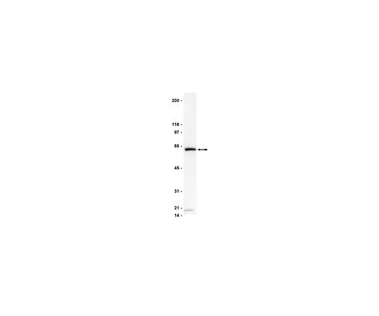 62-8382-03　［已停用］抗DR4/TRAIL-R1;200μg　06-744