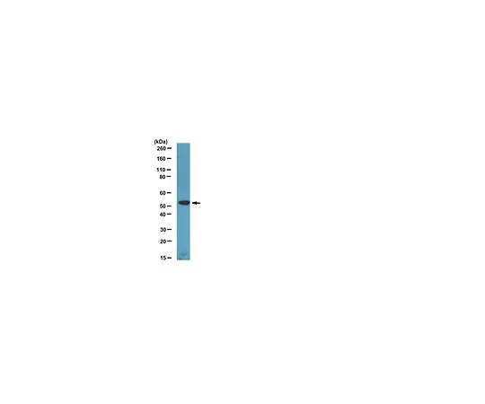 62-8388-42　［已停用］抗FRS3/FRS2β;100μg　07-1825