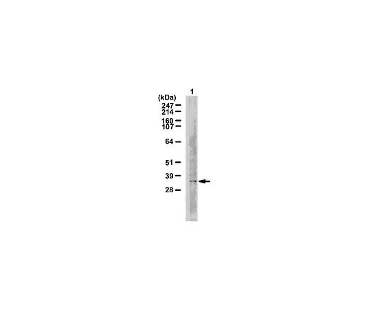 62-8382-58　［已停用］抗TMEM53;100μg　06-1012
