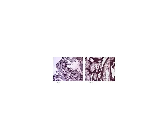 62-8459-55　［已停用］抗Pw1/Peg3;100μg　ABD49