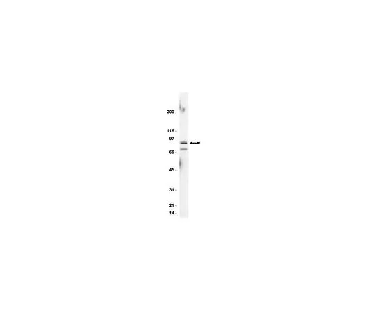 62-8381-82　［已停用］抗StIP-1;200μg　06-650