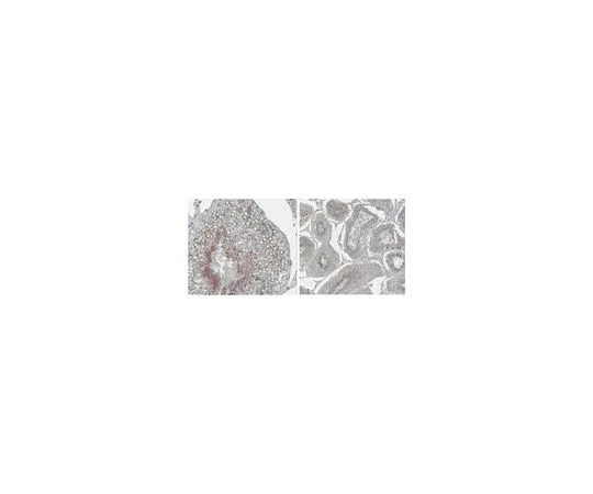 62-8469-64　［已停用］反STK33;200μL　ABS205