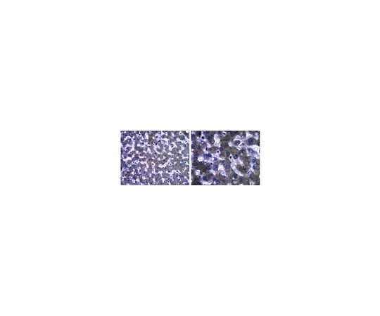 62-8468-98　［已停用］抗载脂蛋白C-III;100μg　ABS17