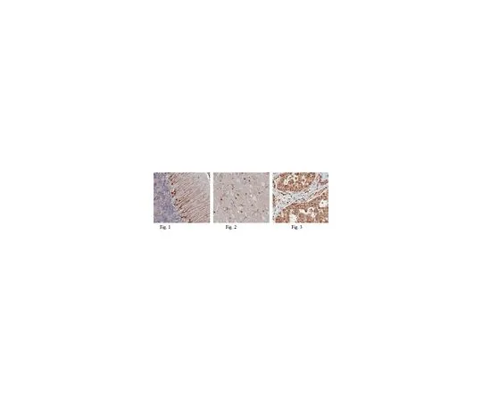 62-8465-99　［已停用］抗ARPC3抗体ABN176　ABN176