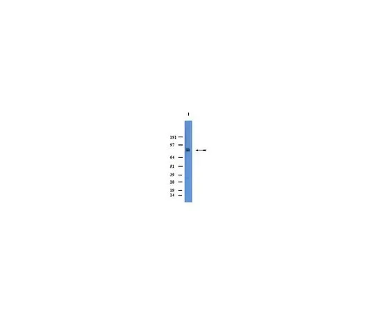 62-8446-49　［已停用］抗去甲肾上腺素转运蛋白;100μg　AB2234