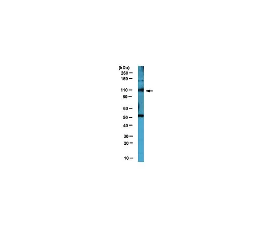 62-8456-66　［已停用］抗神经元受体UNC5B;100μg。　ABC89