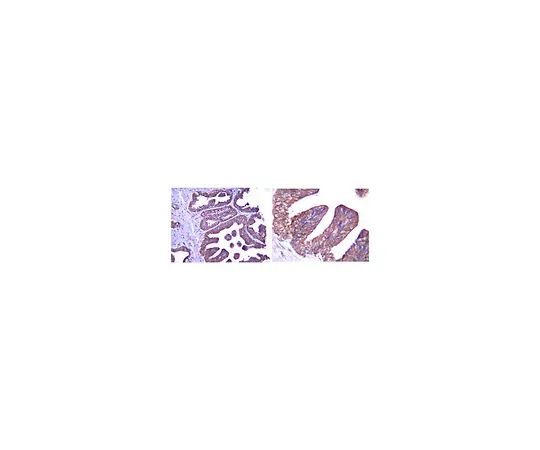 62-8382-92　［已停用］抗干扰素β;200μL　06-1095