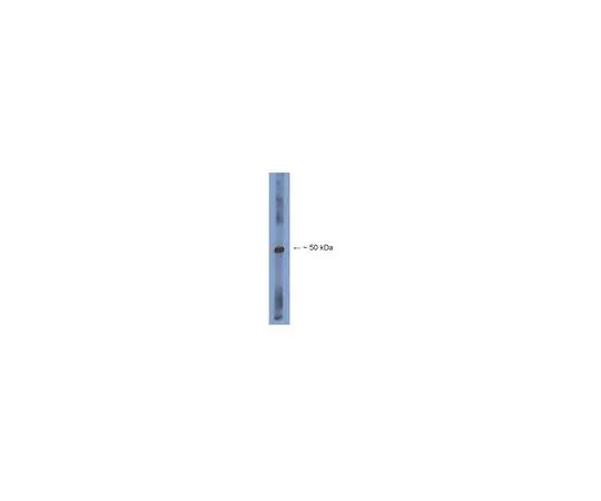 62-8454-98　［已停用］反Sp8;100μg　AB15260