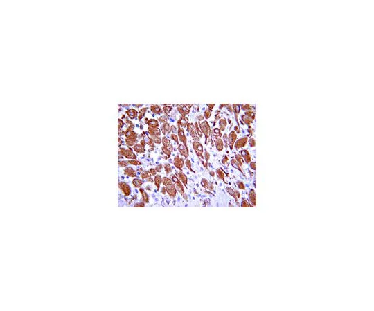 62-8382-96　［已停用］抗蛋白质修补同源物2;100μg　06-1103