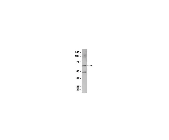 62-8386-22　［已停用］反ZONAB;100μL　07-684