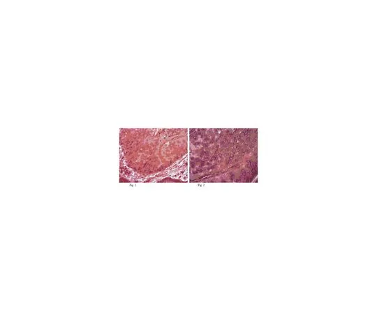 62-8472-32　［已停用］抗波多普兰;100μg　ABT34