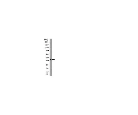 62-8389-86　［已停用］抗RNF2 (Ring1b);100μg　09-723