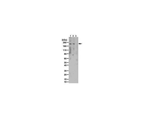 62-8469-40　［已停用］抗磷LRRK2 (Tyr1503);100μg　ABS107