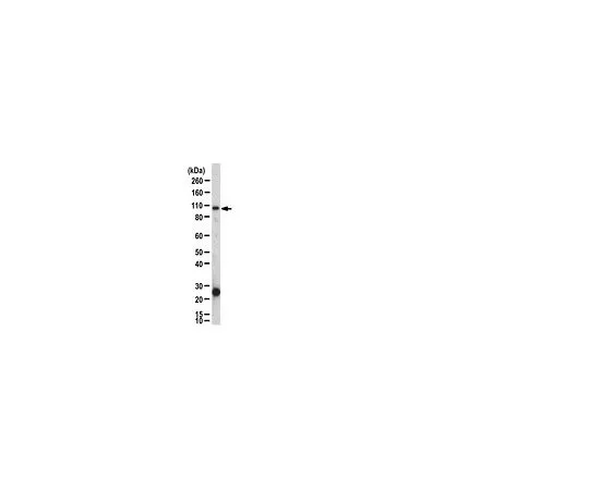 62-8387-11　［已停用］抗IKKβ;150μg　07-1008