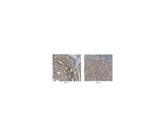 62-8467-03　［已停用］反WWOX　ABN413