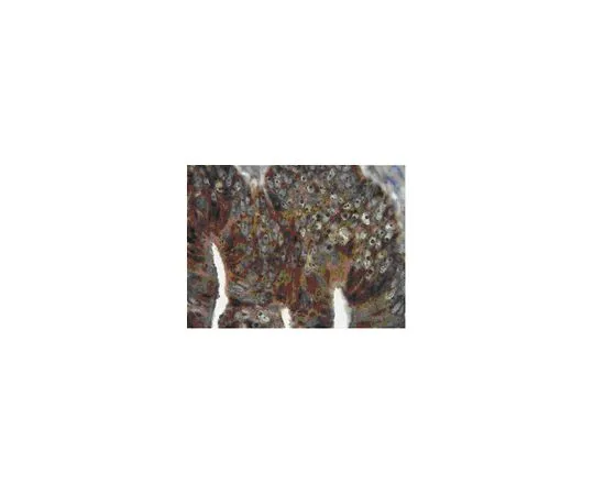 62-8446-96　［已停用］抗MAP1LC3B2;100μg　AB2970