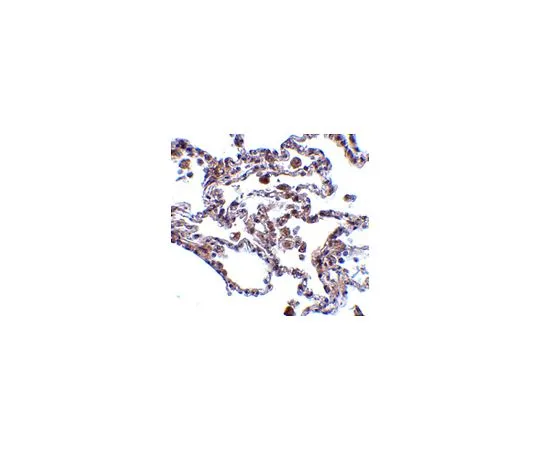 62-8470-13　［已停用］反CIKS　ABS450