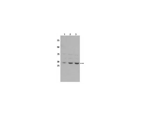 62-8454-10　［已停用］抗GSTθ1;100μg　AB10093