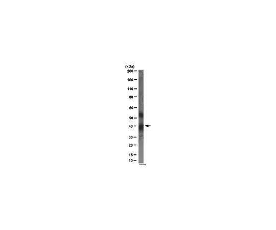 62-8382-75　［已停用］抗蛋白质Wnt-5a;100μg　06-1058