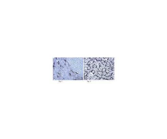 62-8446-65　［已停用］抗CALHM1;100μg　AB2268