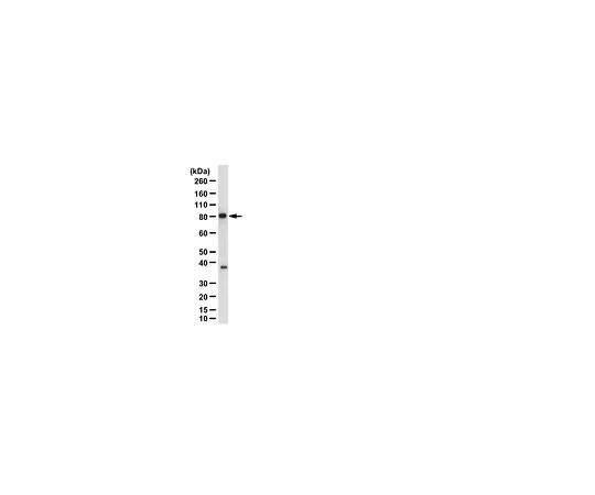 62-8387-10　［已停用］抗IKK;150μg　07-1007