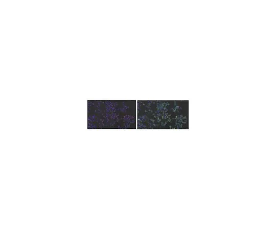 62-8456-57　［已停用］抗真空膜蛋白1 (VMP1);100μg　ABC66