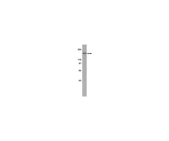 62-8383-59　［已停用］抗HDAC5;200μg　07-045