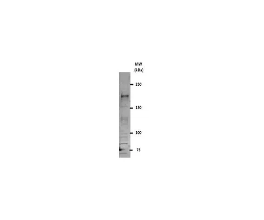 62-8385-76　［已停用］抗REST;200μg　07-579