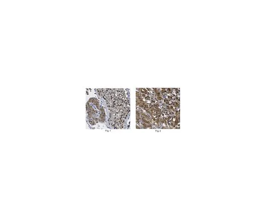 62-8463-59　［已停用］反Cdk1/cdc2C项　ABE1403
