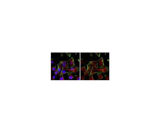 62-8374-44　［已停用］抗PARN,克隆7A7.1;100μg　05-1238