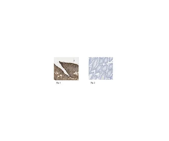 62-8461-55　［已停用］抗HMG盒转录因子1　ABE420