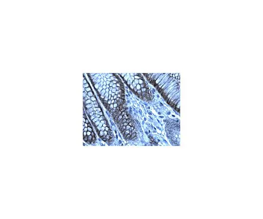 62-8446-95　［已停用］抗格索林;50μg　AB2969
